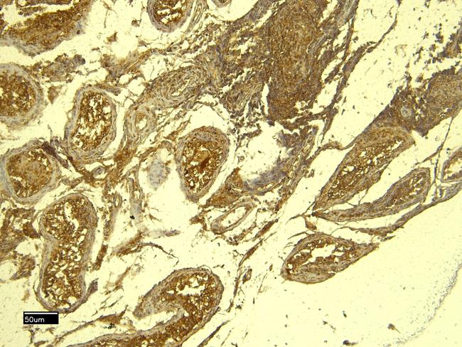 PCNA Antibody in Immunohistochemistry (Paraffin) (IHC (P))