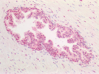 PCNA Antibody in Immunohistochemistry (Paraffin) (IHC (P))