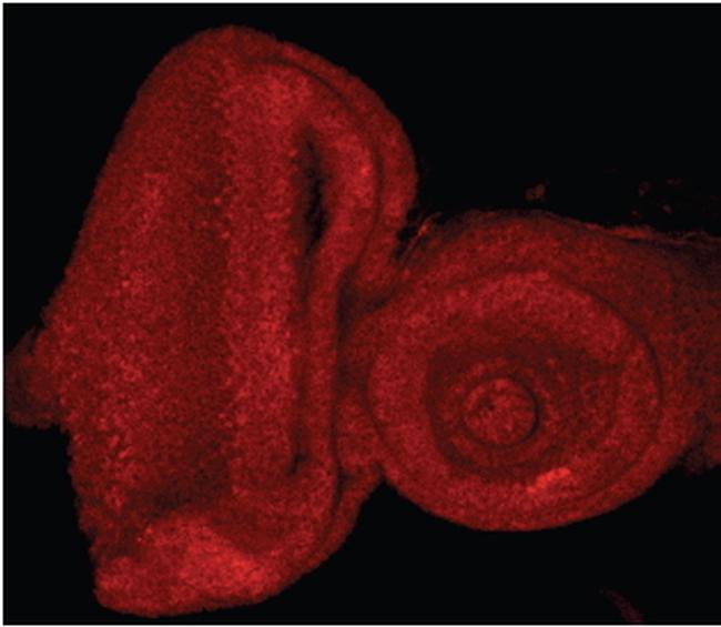 E2F1 Antibody in Immunohistochemistry (IHC)