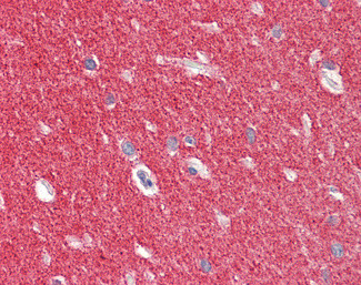 alpha Synuclein Antibody in Immunohistochemistry (Paraffin) (IHC (P))