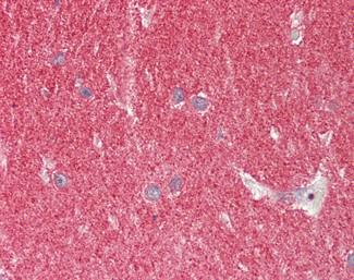 alpha Synuclein Antibody in Immunohistochemistry (Paraffin) (IHC (P))