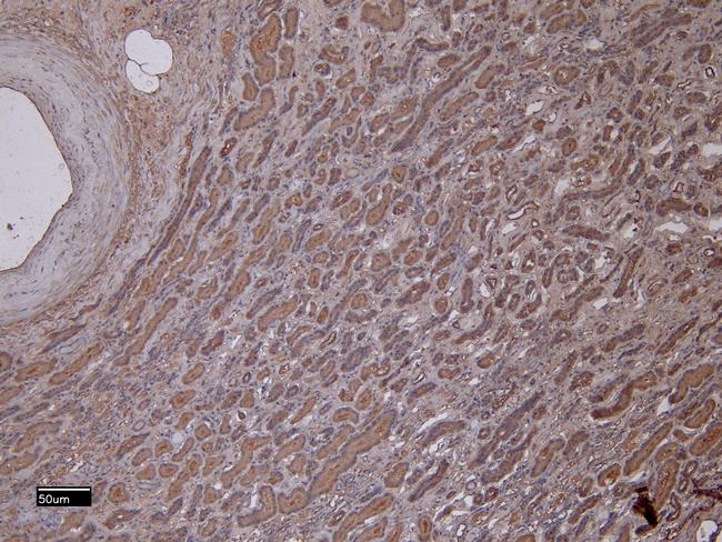 MMP3 Antibody in Immunohistochemistry (Paraffin) (IHC (P))