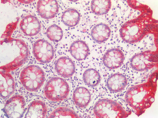 Cytokeratin 20 Antibody in Immunohistochemistry (Paraffin) (IHC (P))