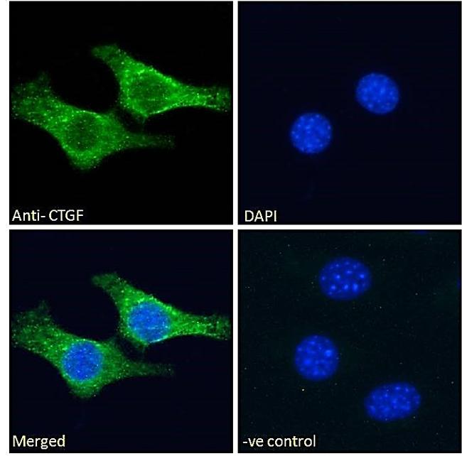 CTGF Antibody in Immunocytochemistry (ICC/IF)