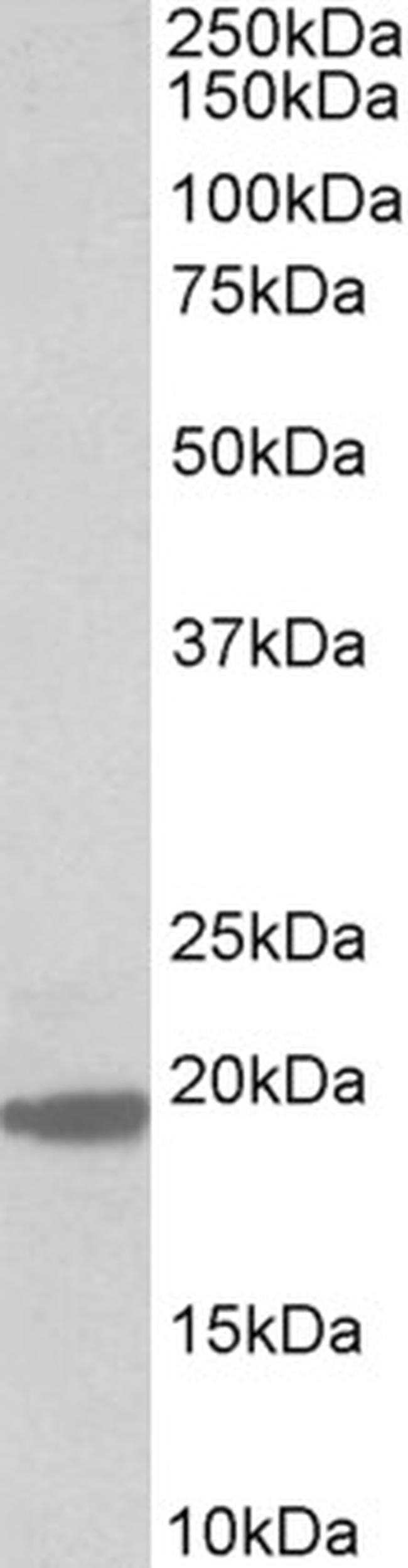 MCTS1 Antibody in Western Blot (WB)