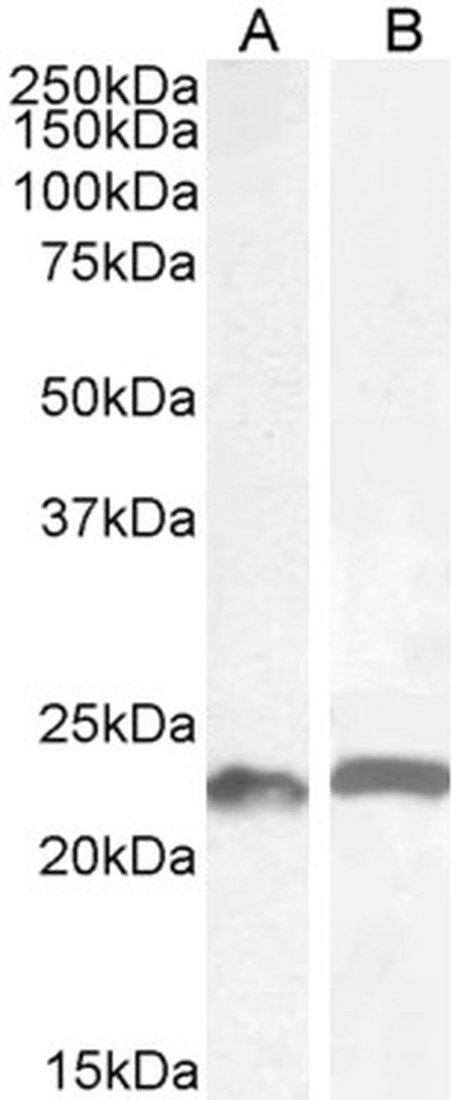 LIF Antibody in Western Blot (WB)