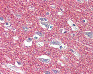 AP2A1 Antibody in Immunohistochemistry (Paraffin) (IHC (P))