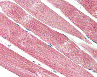 THNSL2 Antibody in Immunohistochemistry (Paraffin) (IHC (P))