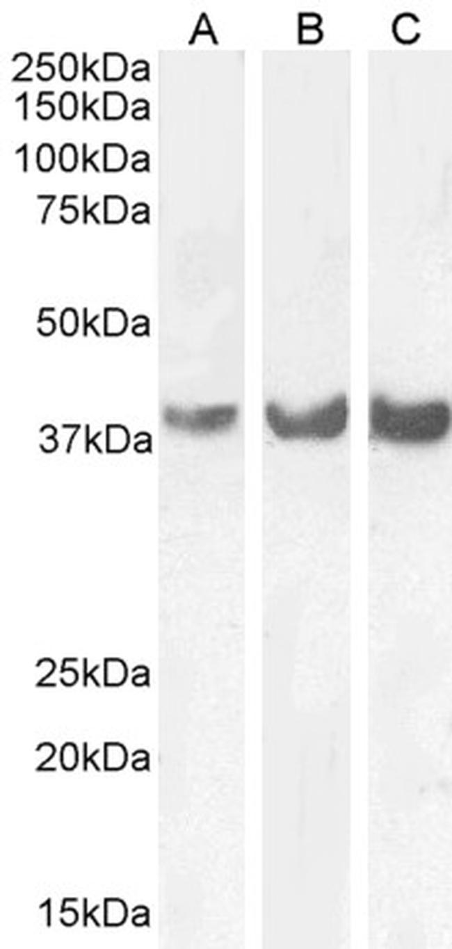 HOXD13 Antibody in Western Blot (WB)