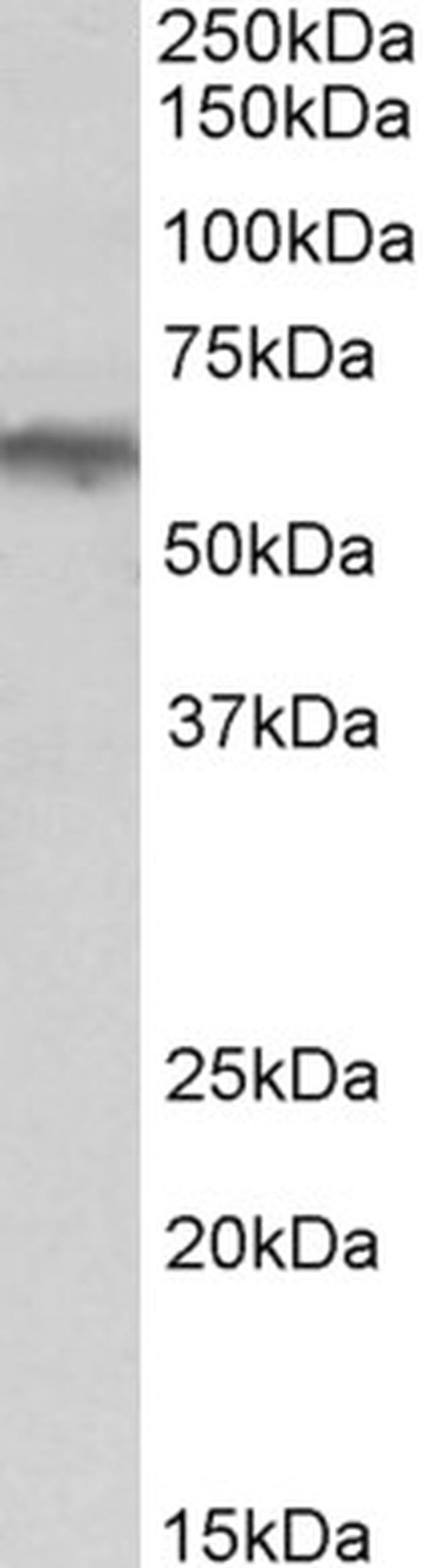 alpha-1b Adrenergic Receptor Antibody in Western Blot (WB)