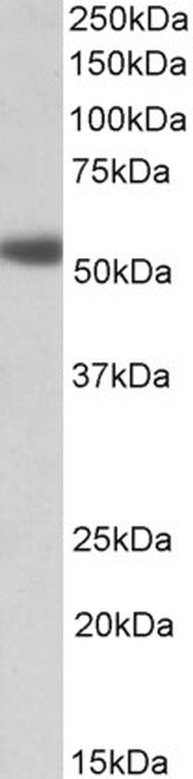 alpha-1a Adrenergic Receptor Antibody in Western Blot (WB)