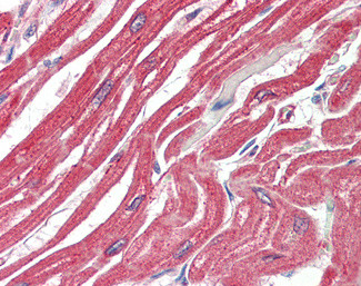 MAPKAPK2 Antibody in Immunohistochemistry (Paraffin) (IHC (P))