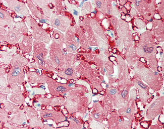 Creatine Kinase MM Antibody in Immunohistochemistry (Paraffin) (IHC (P))