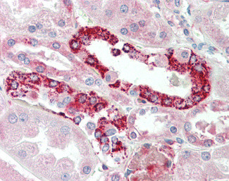 PLK3 Antibody in Immunohistochemistry (Paraffin) (IHC (P))