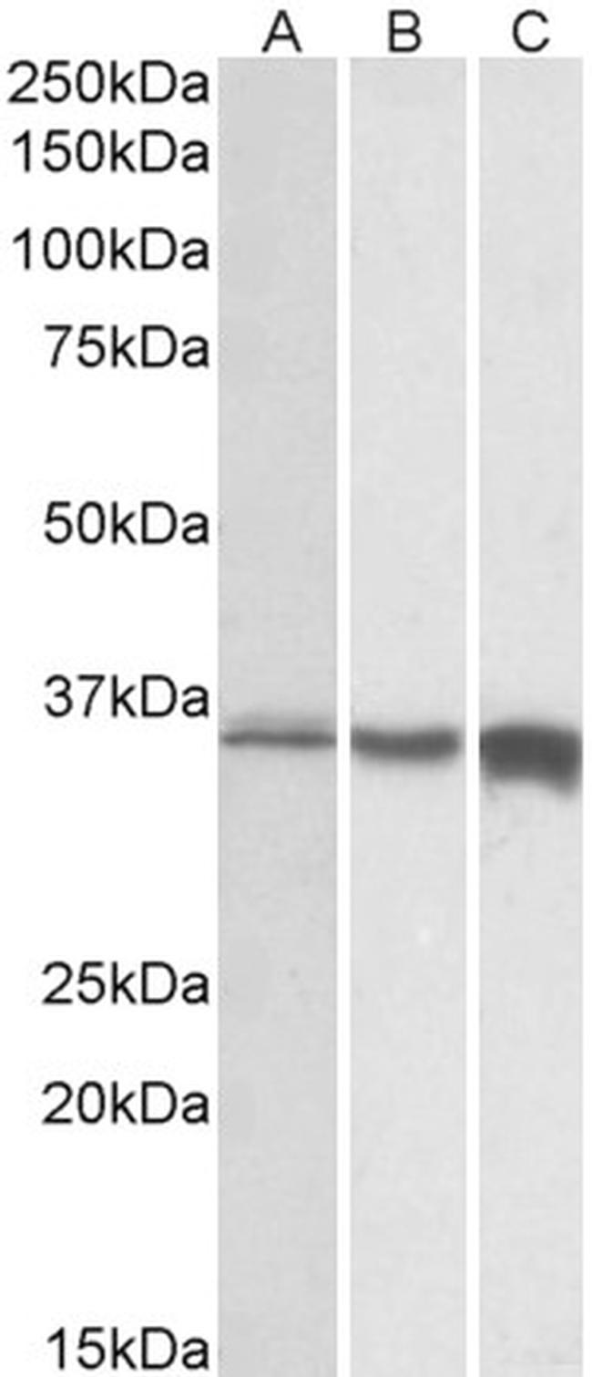 TNNT3 Antibody in Western Blot (WB)