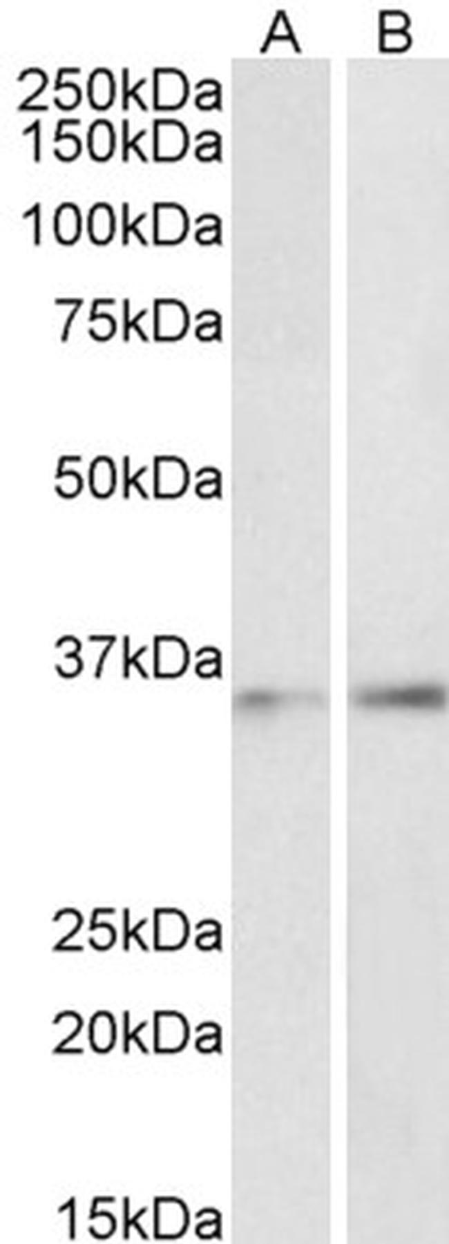 C/EBP beta Antibody in Western Blot (WB)