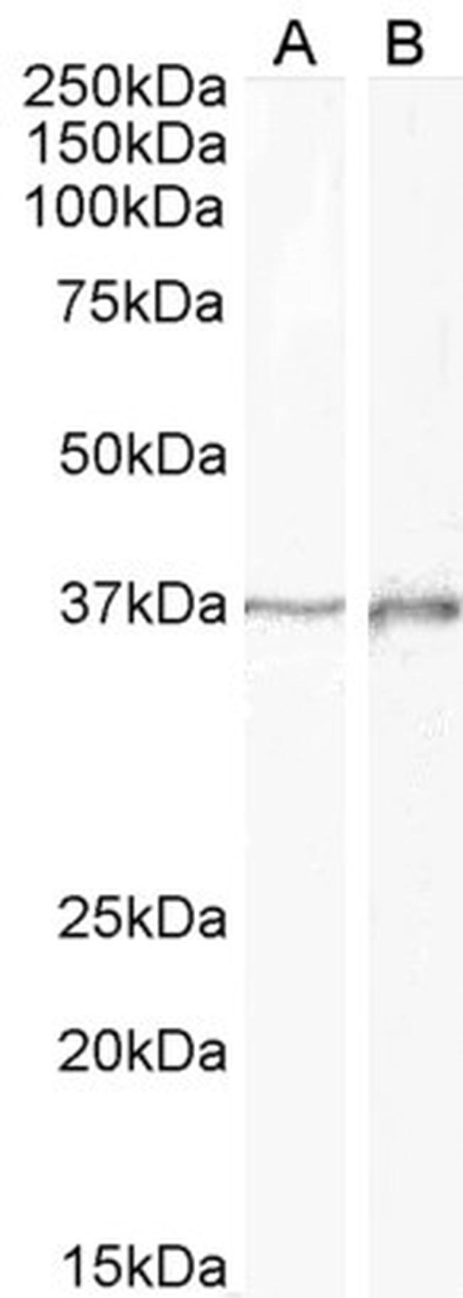 DLX2 Antibody in Western Blot (WB)