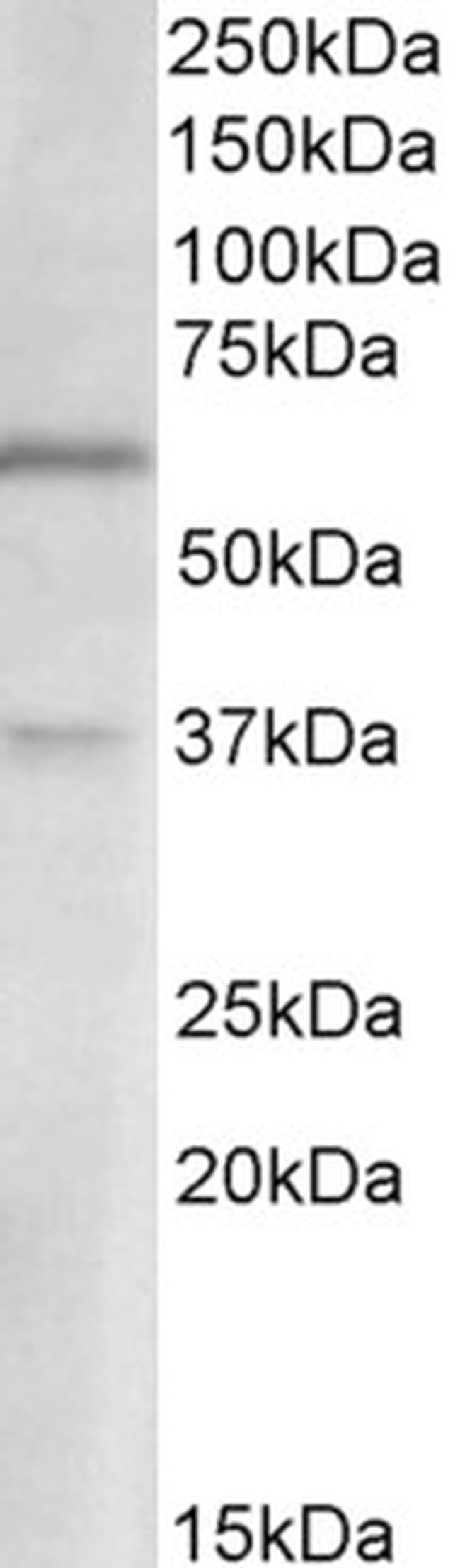 VGLUT2 Antibody in Western Blot (WB)