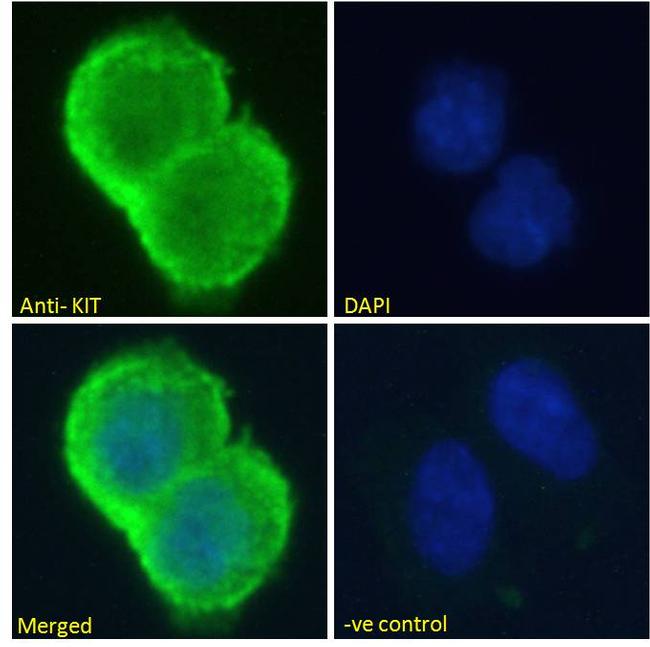 c-Kit Antibody in Immunocytochemistry (ICC/IF)