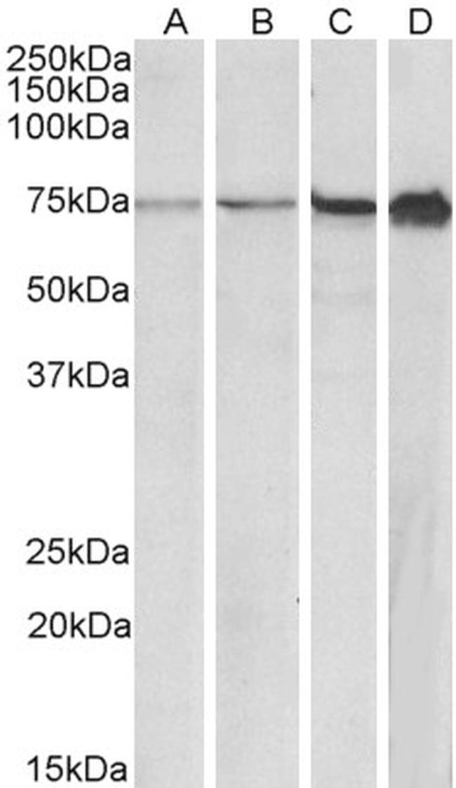 RPA70 Antibody in Western Blot (WB)