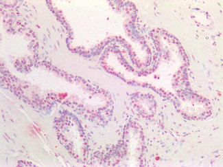 HOXA5 Antibody in Immunohistochemistry (Paraffin) (IHC (P))