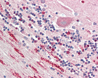 NPTX1 Antibody in Immunohistochemistry (Paraffin) (IHC (P))