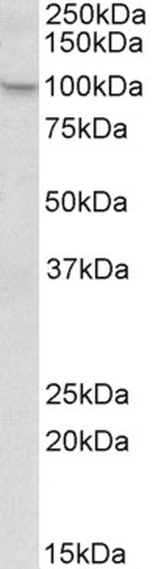 NALP12 Antibody in Western Blot (WB)