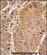 ApoA1 Antibody in Immunohistochemistry (Paraffin) (IHC (P))