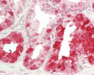 NELL2 Antibody in Immunohistochemistry (Paraffin) (IHC (P))