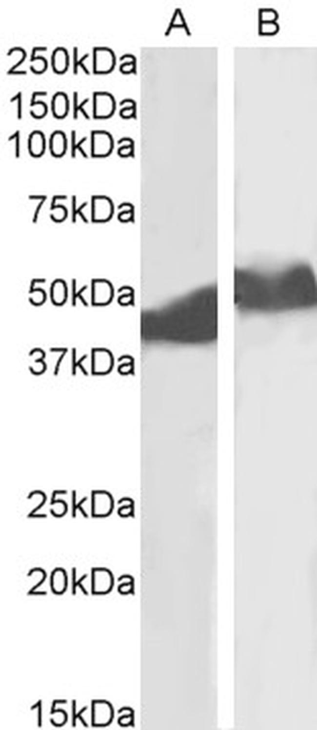 alpha-1 Antitrypsin Antibody in Western Blot (WB)