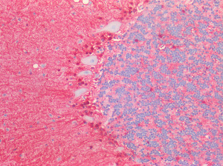 S100B Antibody in Immunohistochemistry (Paraffin) (IHC (P))