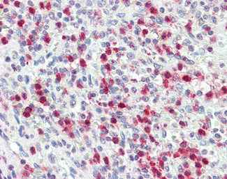 PR3 Antibody in Immunohistochemistry (Paraffin) (IHC (P))