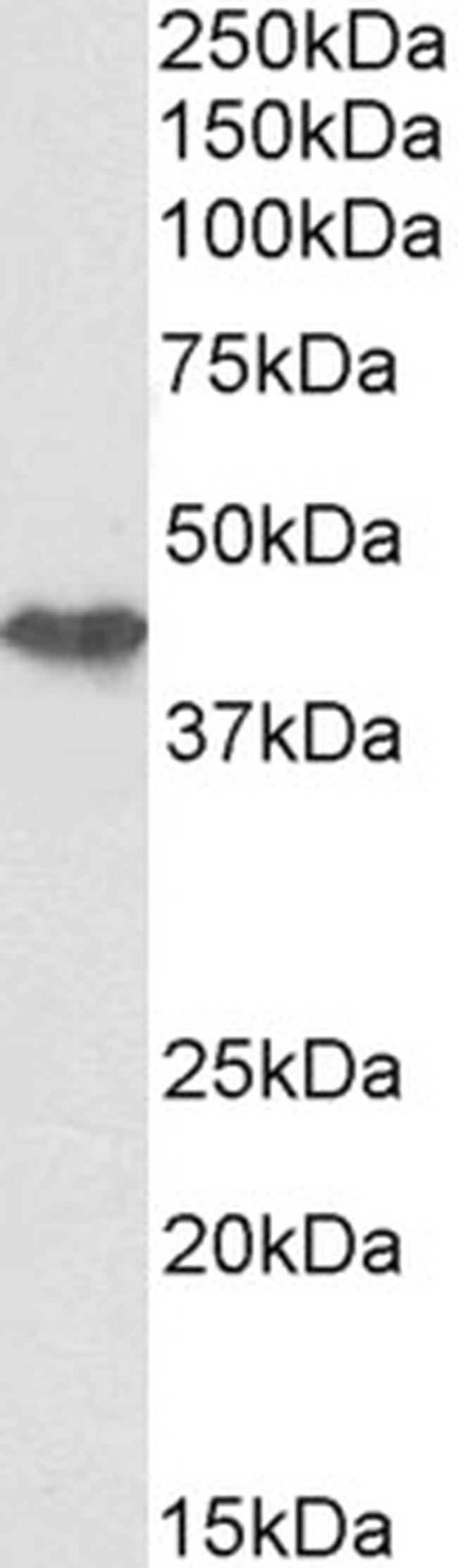 Cytokeratin 19 Antibody in Western Blot (WB)