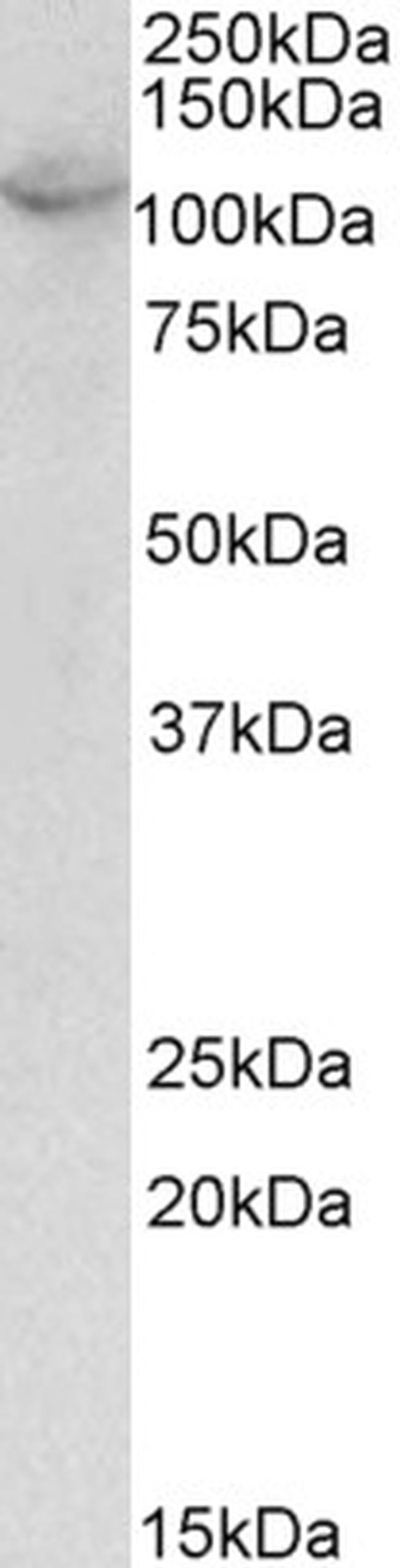 OAS3 Antibody in Western Blot (WB)