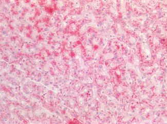 Fibrinogen alpha chain Antibody in Immunohistochemistry (Paraffin) (IHC (P))