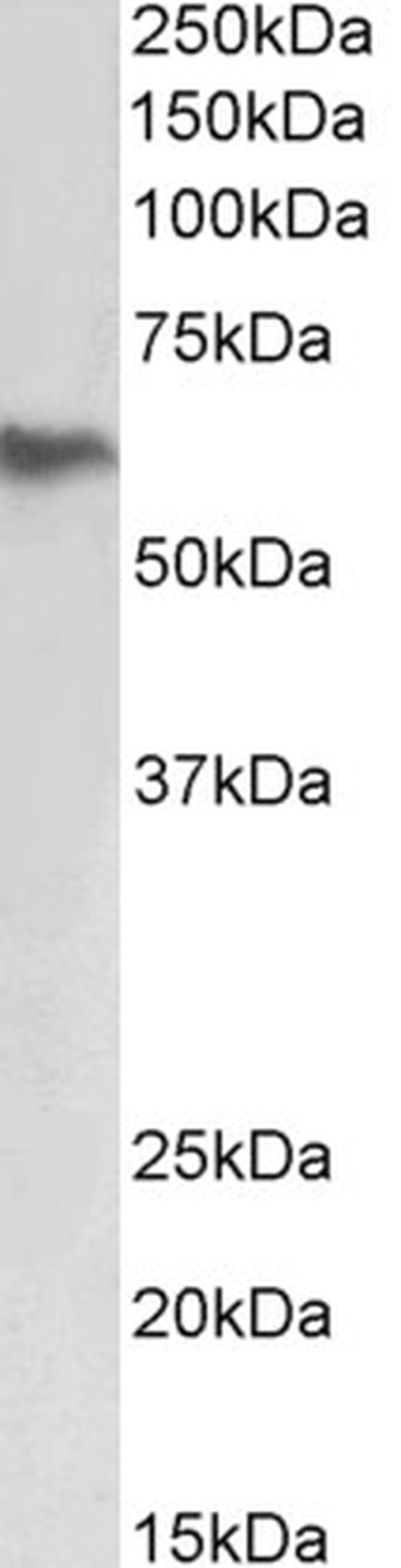 FIBB Antibody in Western Blot (WB)