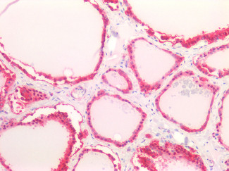 LDHB Antibody in Immunohistochemistry (Paraffin) (IHC (P))