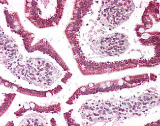 PLA2G2A Antibody in Immunohistochemistry (Paraffin) (IHC (P))