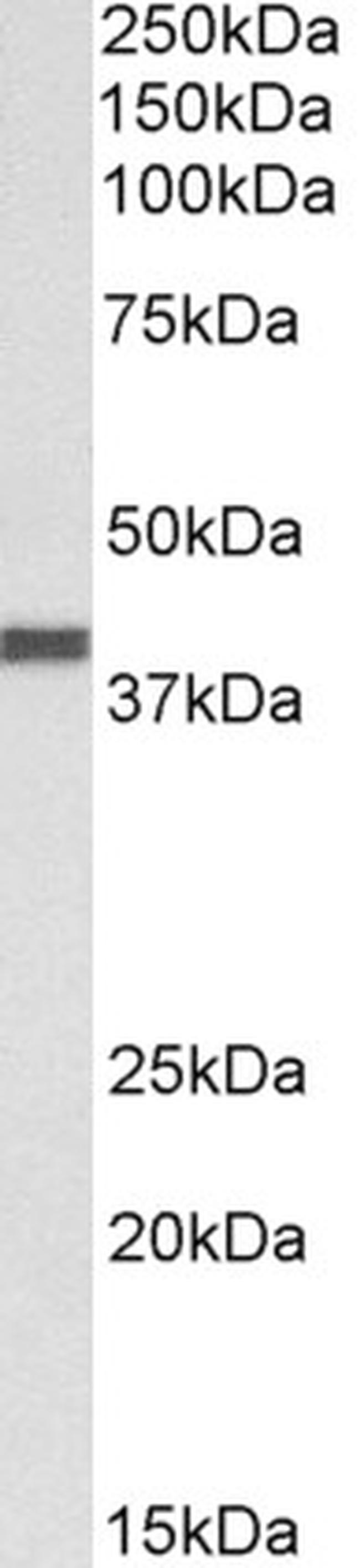 CXCR1 Antibody in Western Blot (WB)