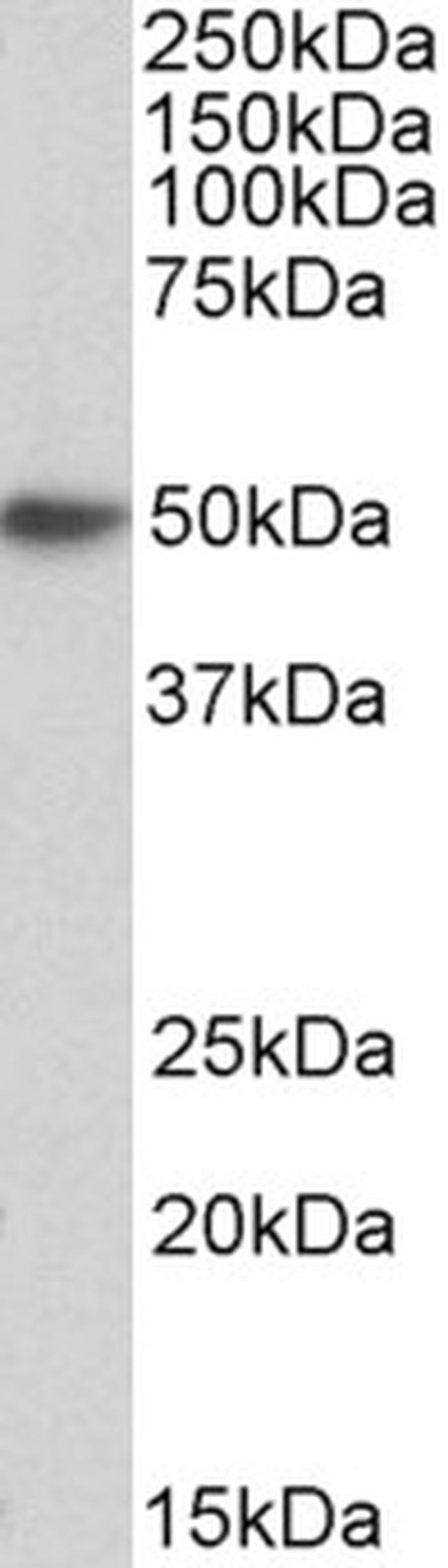 FceR1 alpha Antibody in Western Blot (WB)