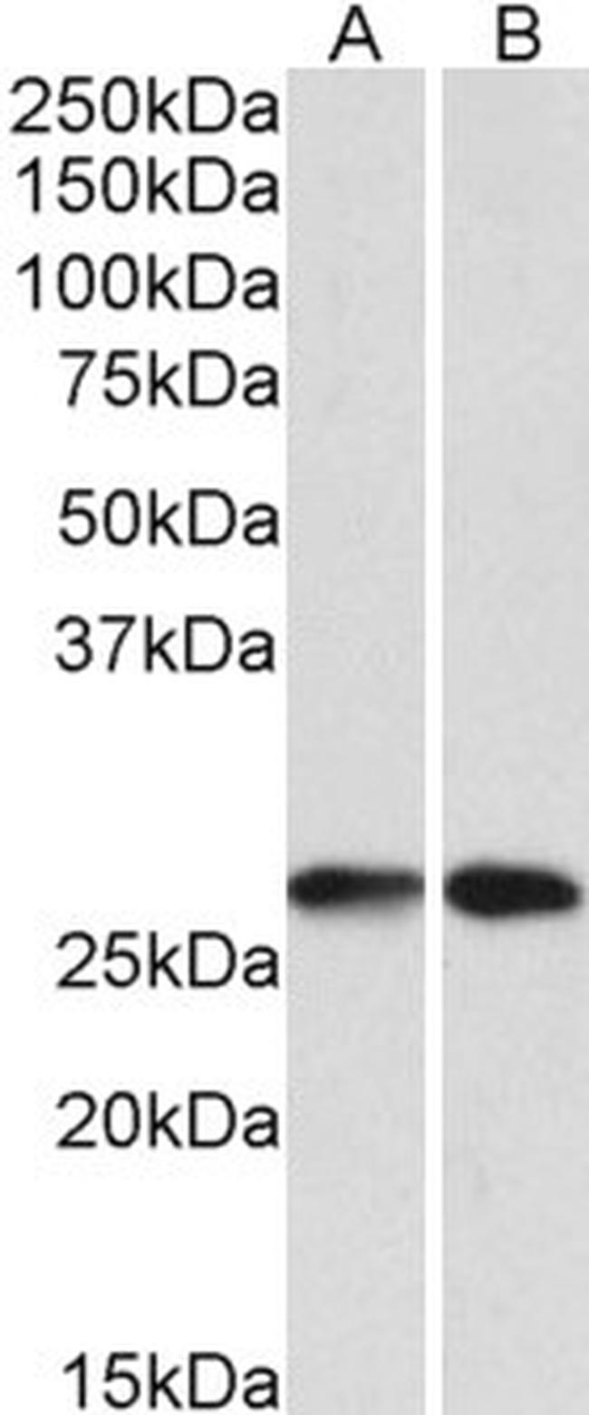 NNMT Antibody in Western Blot (WB)