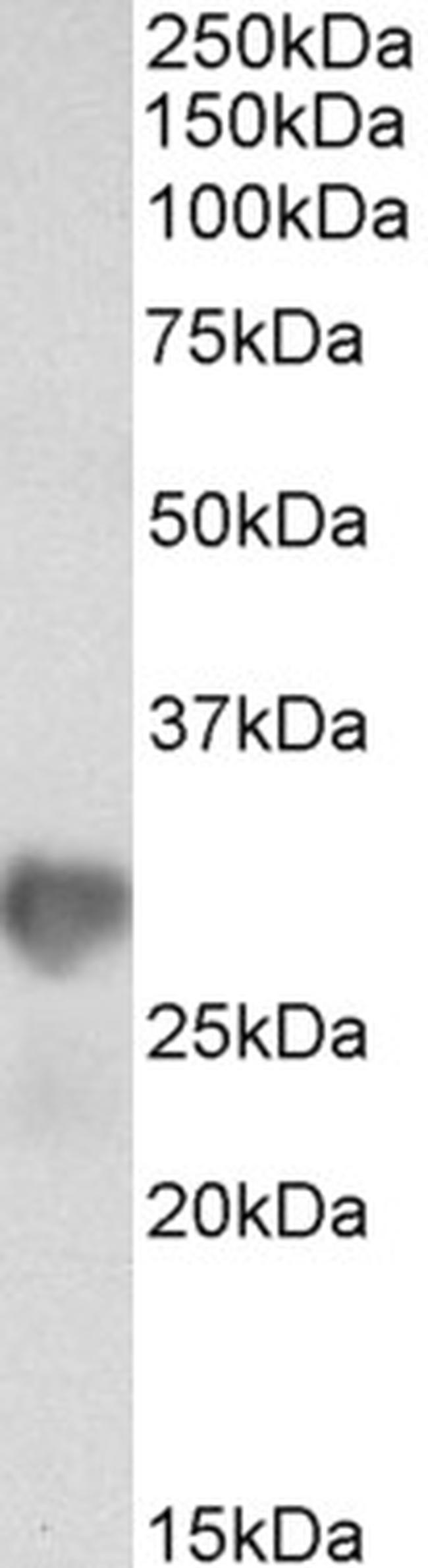 NNMT Antibody in Western Blot (WB)