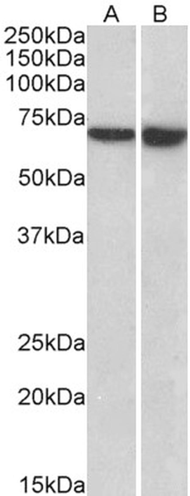 L-Plastin Antibody in Western Blot (WB)