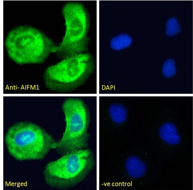 AIF Antibody in Immunocytochemistry (ICC/IF)