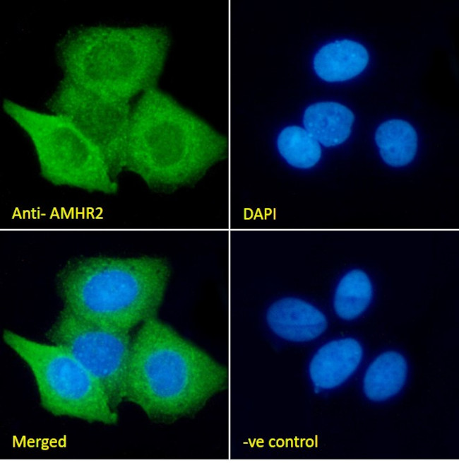 AMHR2 Antibody in Immunocytochemistry (ICC/IF)