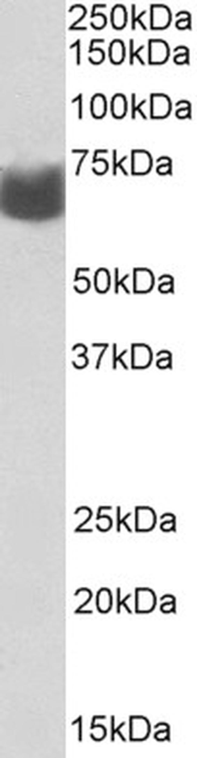 AMHR2 Antibody in Western Blot (WB)