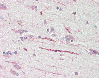 ASIC1 Antibody in Immunohistochemistry (Paraffin) (IHC (P))