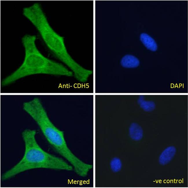 VE-cadherin Antibody in Immunocytochemistry (ICC/IF)