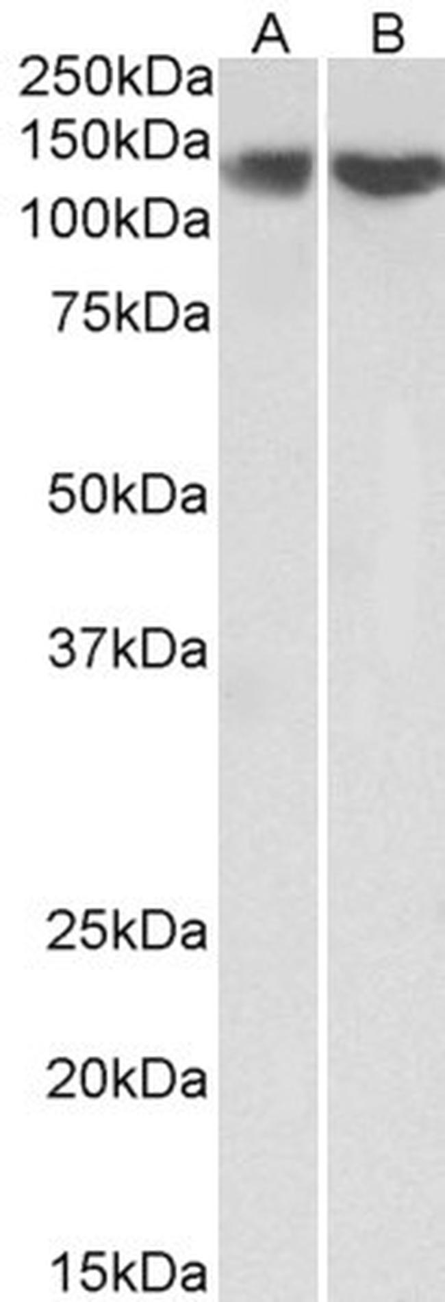 REST Antibody in Western Blot (WB)