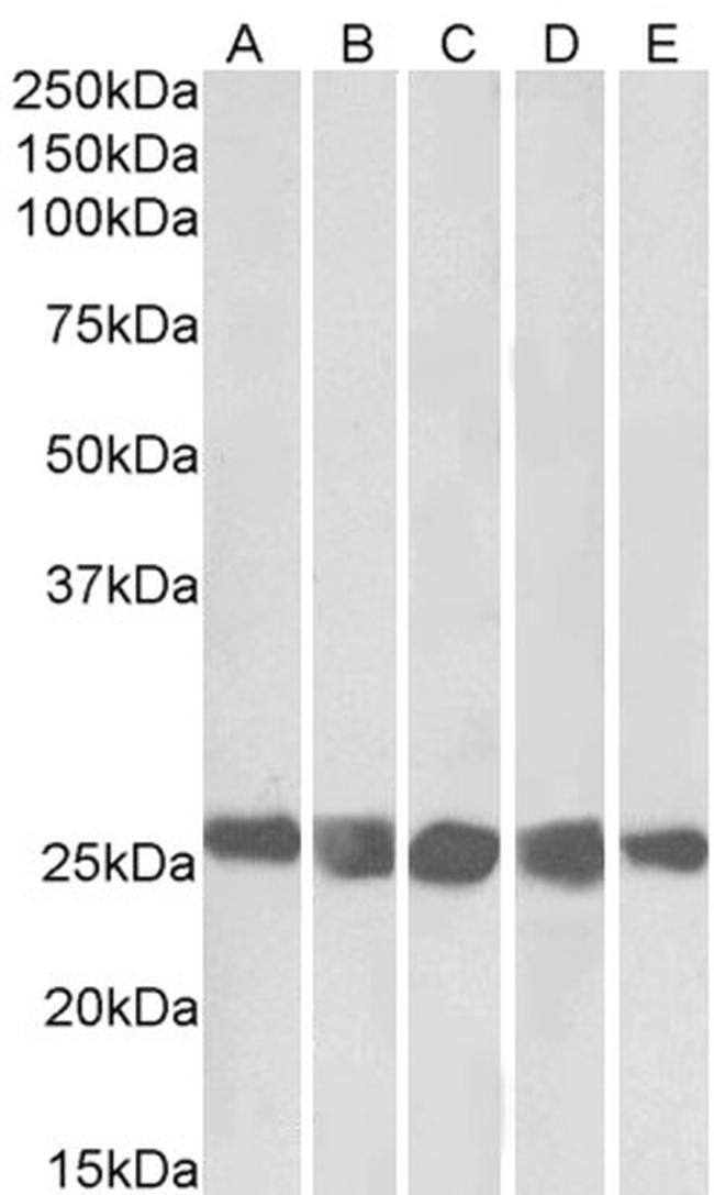 CK2 beta Antibody in Western Blot (WB)